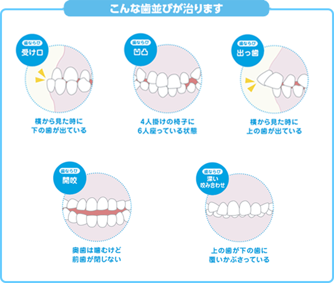 プレオルソ | 佐野市の歯医者 よこづか歯科医院