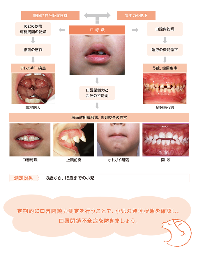 口唇閉鎖力測定の重要性
